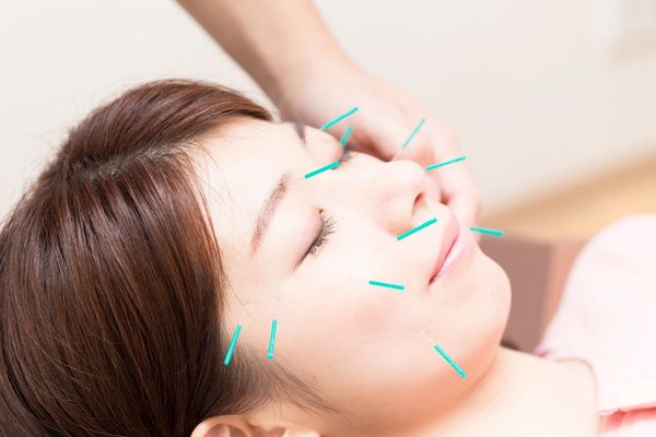 美容鍼はどんなことに効く？美容鍼の効果を徹底解説！